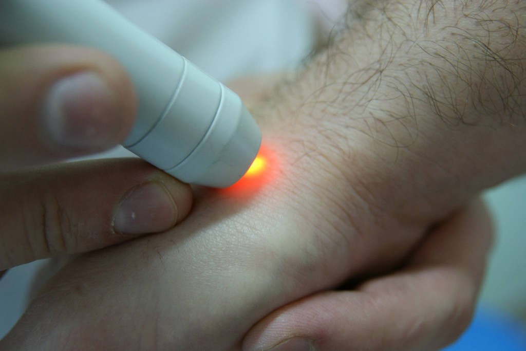 zabiegi laser magdomed kalisz